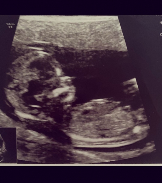 Беременная Гоар Аветисян показала первое фото малыша