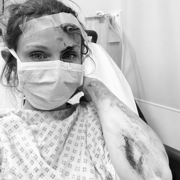 Певица Софи Эллис-Бекстор госпитализирована с травмами: жуткое фото из больницы 
