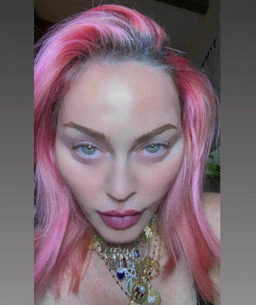 62-летняя Мадонна испугала фанатов лицом, как у инопланетянина: фото