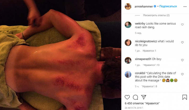 7 садистских постов в Instagram "каннибала" Арми Хаммера: как оскандалился актер