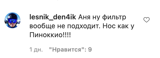 В Сети заговорили о новой пластической операции Седоковой: Неужели так себя не любите?