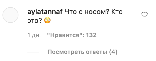 В Сети заговорили о новой пластической операции Седоковой: Неужели так себя не любите?