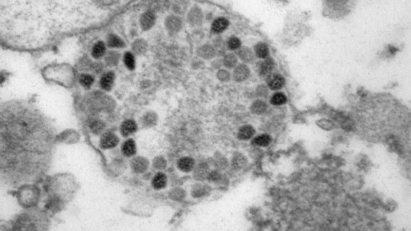 Как выявить "омикрон" без теста на коронавирус