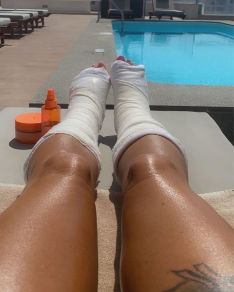 А фанаты не верят: Кэти Прайс сломала обе ноги на отдыхе в Турции