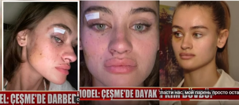 Появилось видео избиения украинской модели на турецком курорте