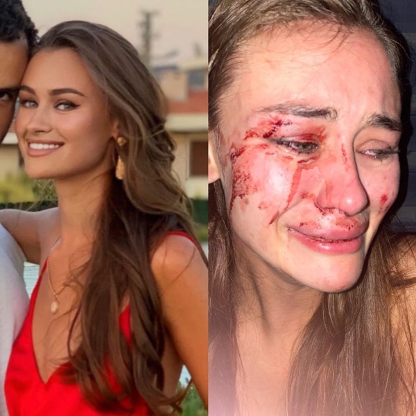 Появилось видео избиения украинской модели на турецком курорте