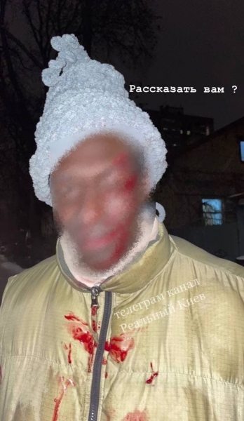 В Киеве водитель такси Bolt избил и оскорбил пассажира: в компании отреагировали